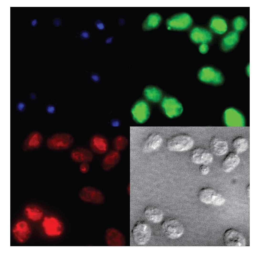 stained organelles